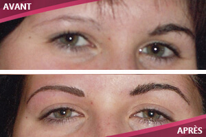 Dermopigmentation réparatrice. Maquillage Permanent Johanne Bérubé