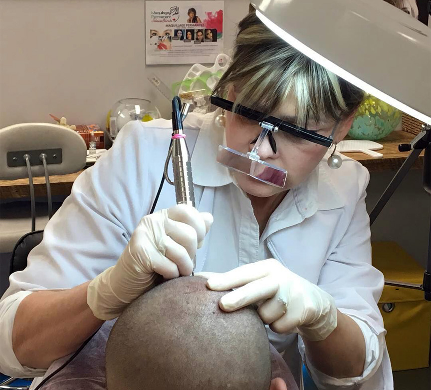 Scalp Micropigmentation capillaire - hair tattoo